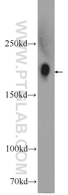 Western Blot (WB) analysis of SMMC-7721 cells using Integrin alpha-1 Polyclonal antibody (22146-1-AP)