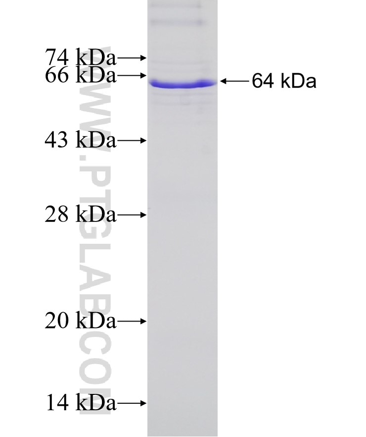 Integrin alpha-1 fusion protein Ag17584 SDS-PAGE