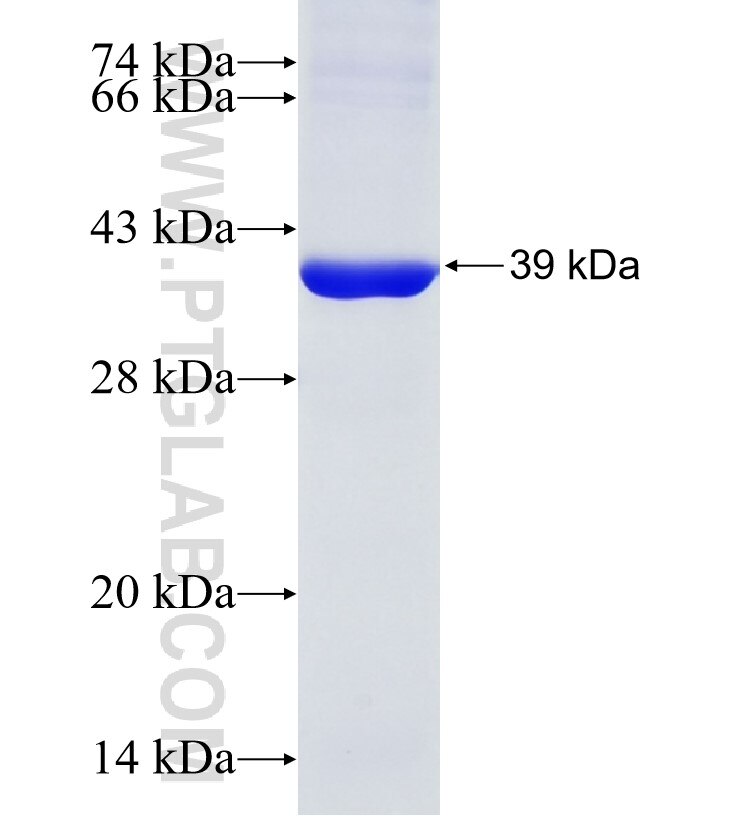 ITGA2 fusion protein Ag32780 SDS-PAGE ITGA2 fusion protein Ag32780 SDS-PAGE