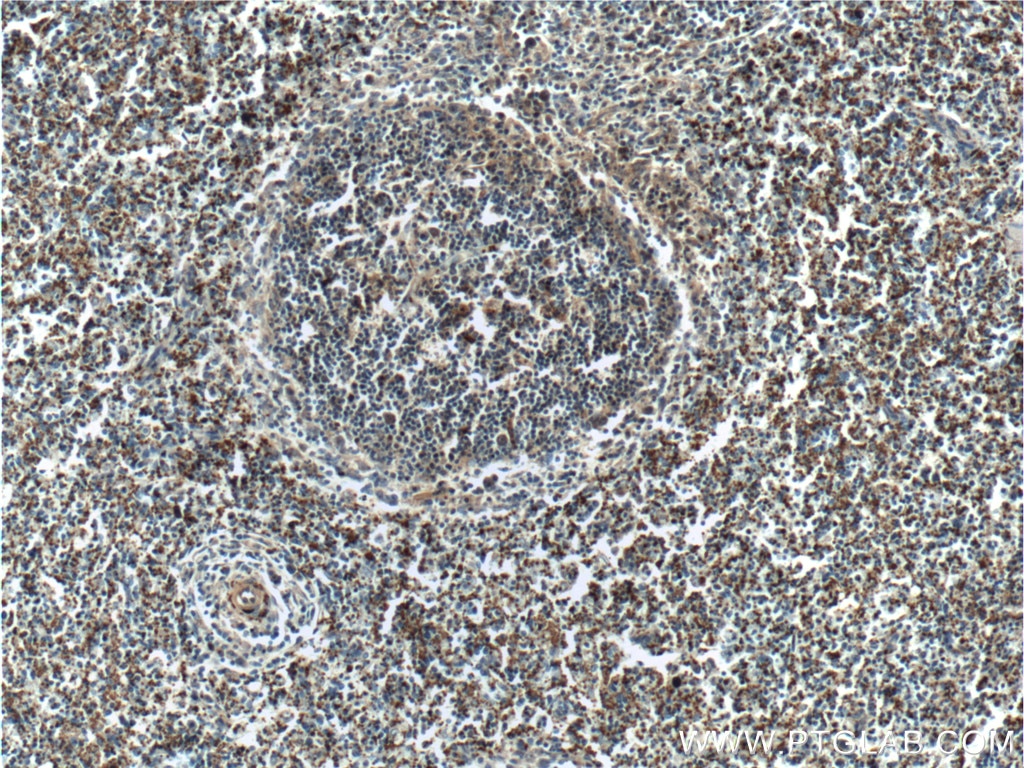Immunohistochemistry (IHC) staining of human spleen tissue using CD41/Integrin Alpha 2B Polyclonal antibody (18308-1-AP)