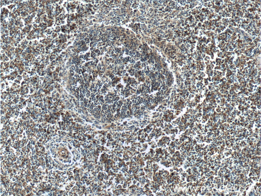 IHC staining of human spleen using 18308-1-AP