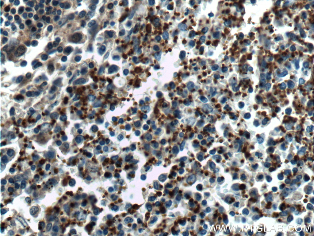 Immunohistochemistry (IHC) staining of human spleen tissue using CD41/Integrin Alpha 2B Polyclonal antibody (18308-1-AP)
