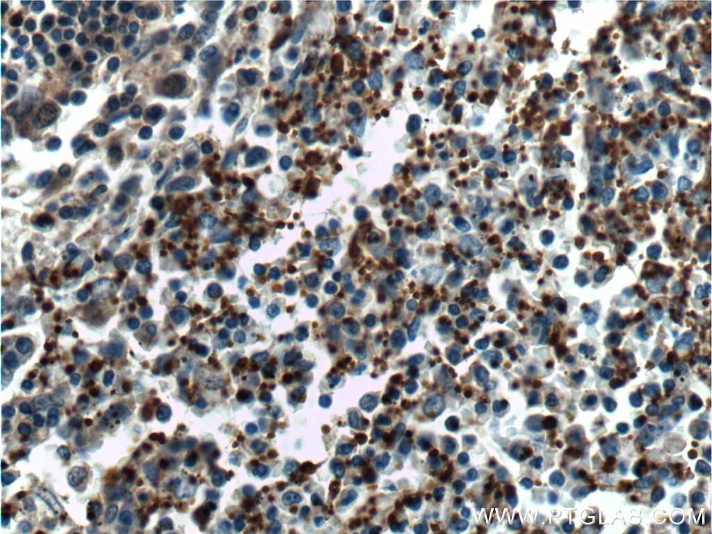 IHC staining of human spleen using 18308-1-AP