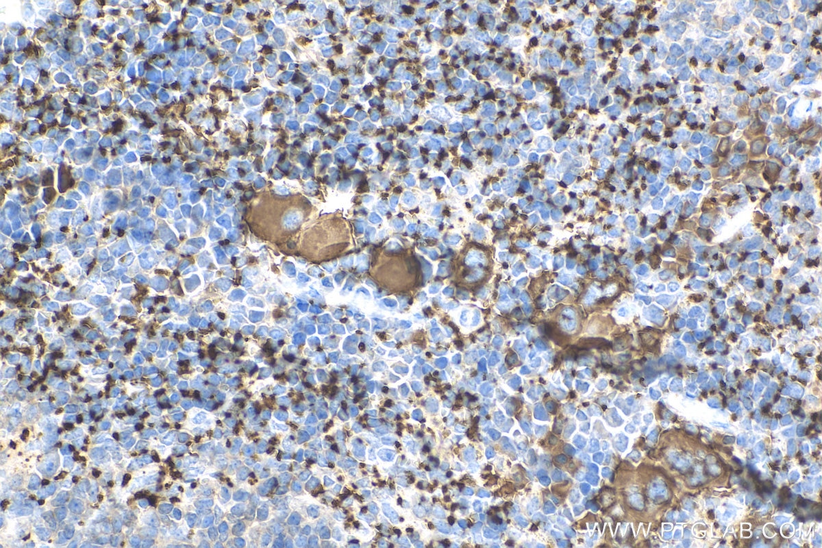 Immunohistochemistry (IHC) staining of mouse spleen tissue using CD41/Integrin Alpha 2B Polyclonal antibody (24552-1-AP)
