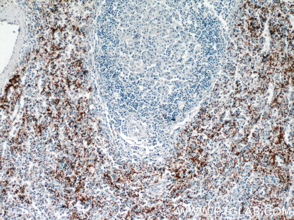 Immunohistochemistry (IHC) staining of human spleen tissue using CD41/Integrin Alpha 2B Polyclonal antibody (24552-1-AP)