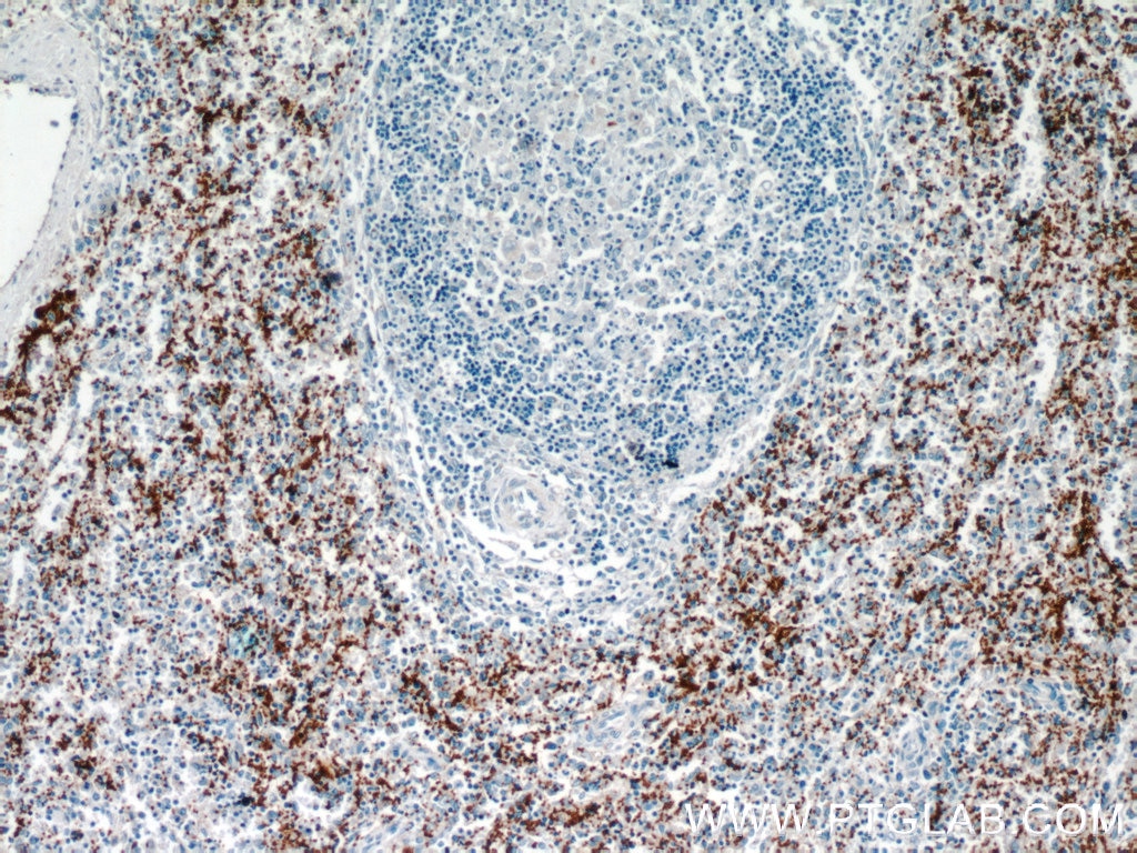 IHC staining of human spleen using 24552-1-AP