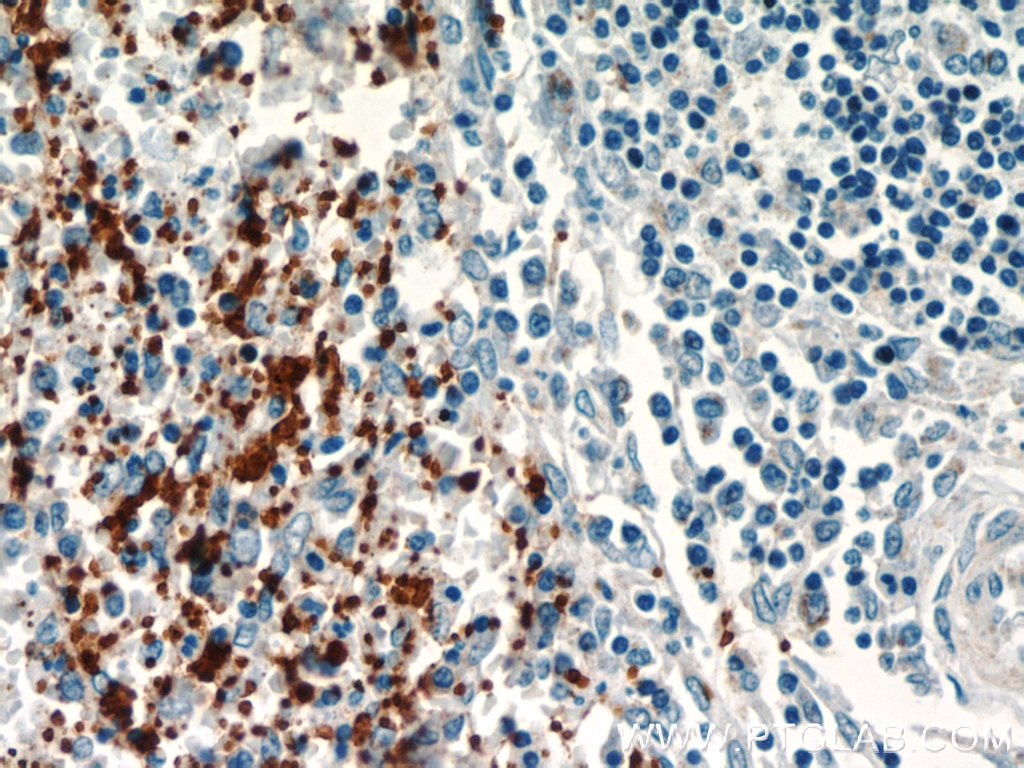 Immunohistochemistry (IHC) staining of human spleen tissue using CD41/Integrin Alpha 2B Polyclonal antibody (24552-1-AP)