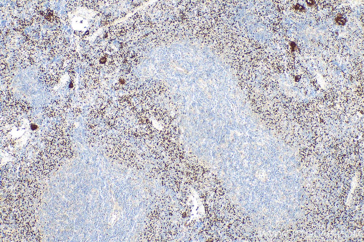 Immunohistochemistry (IHC) staining of rat spleen tissue using CD41 Polyclonal antibody (24552-1-AP)