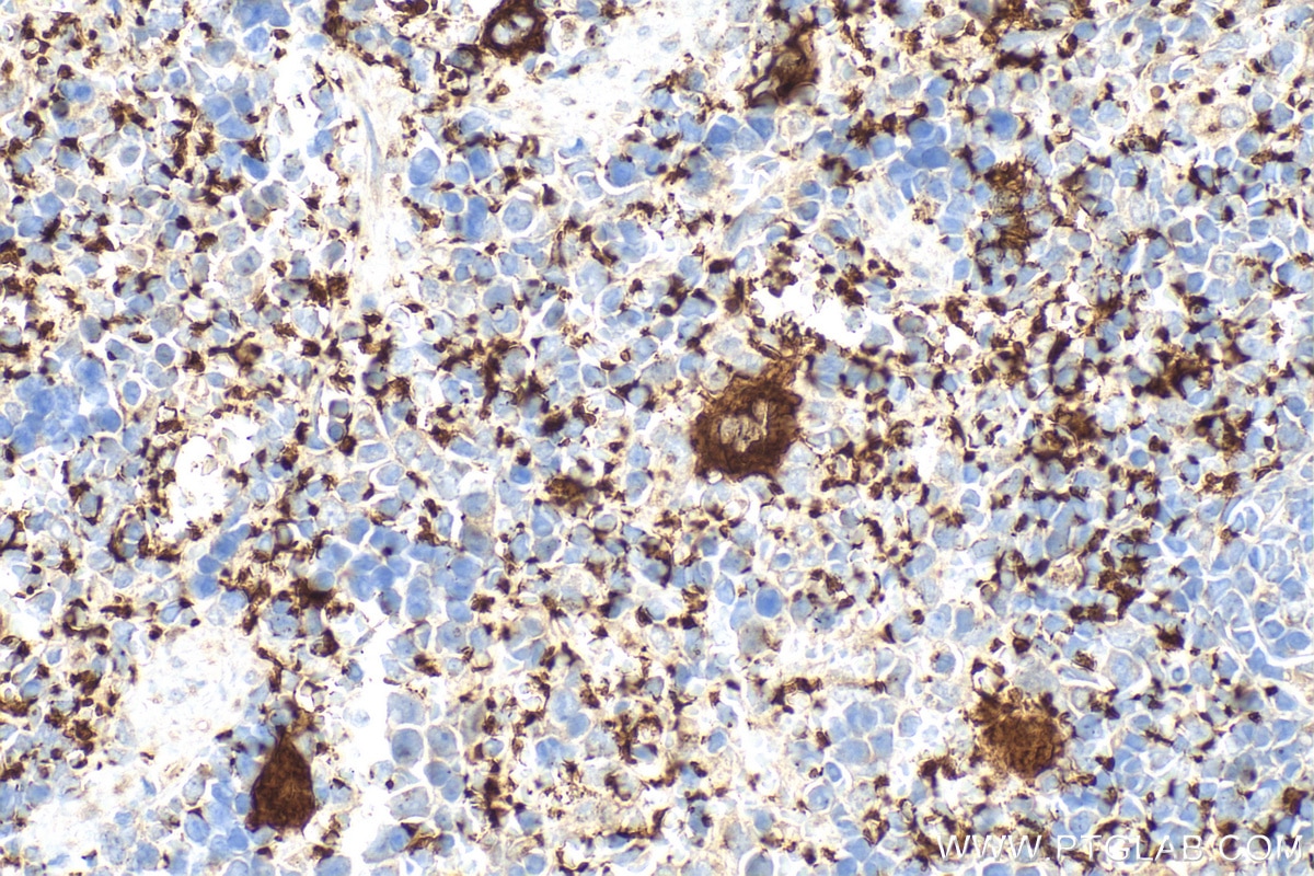 Immunohistochemistry (IHC) staining of rat spleen tissue using CD41 Polyclonal antibody (24552-1-AP)