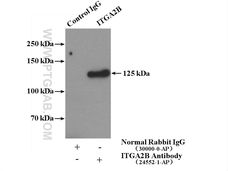 Immunoprecipitation (IP) experiment of human plasma using CD41/Integrin Alpha 2B Polyclonal antibody (24552-1-AP)