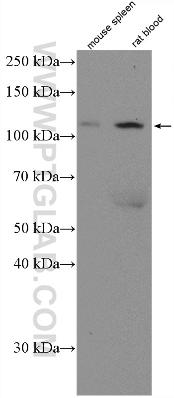 Western Blot (WB) analysis of rat blood using CD41/Integrin Alpha 2B Polyclonal antibody (24552-1-AP)