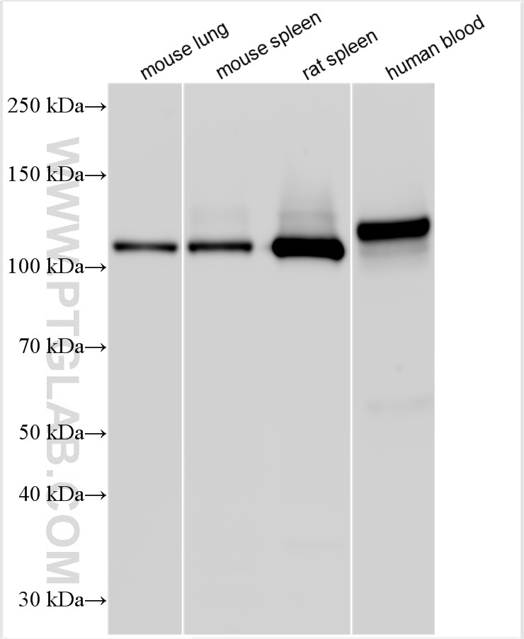 Western Blot (WB) analysis of various lysates using CD41/Integrin Alpha 2B Polyclonal antibody (24552-1-AP)