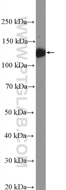 CD41/Integrin alpha 2b Polyclonal antibody