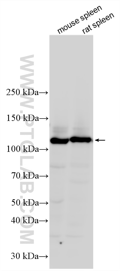 Western Blot (WB) analysis of various lysates using CD41 Polyclonal antibody (24552-1-AP)