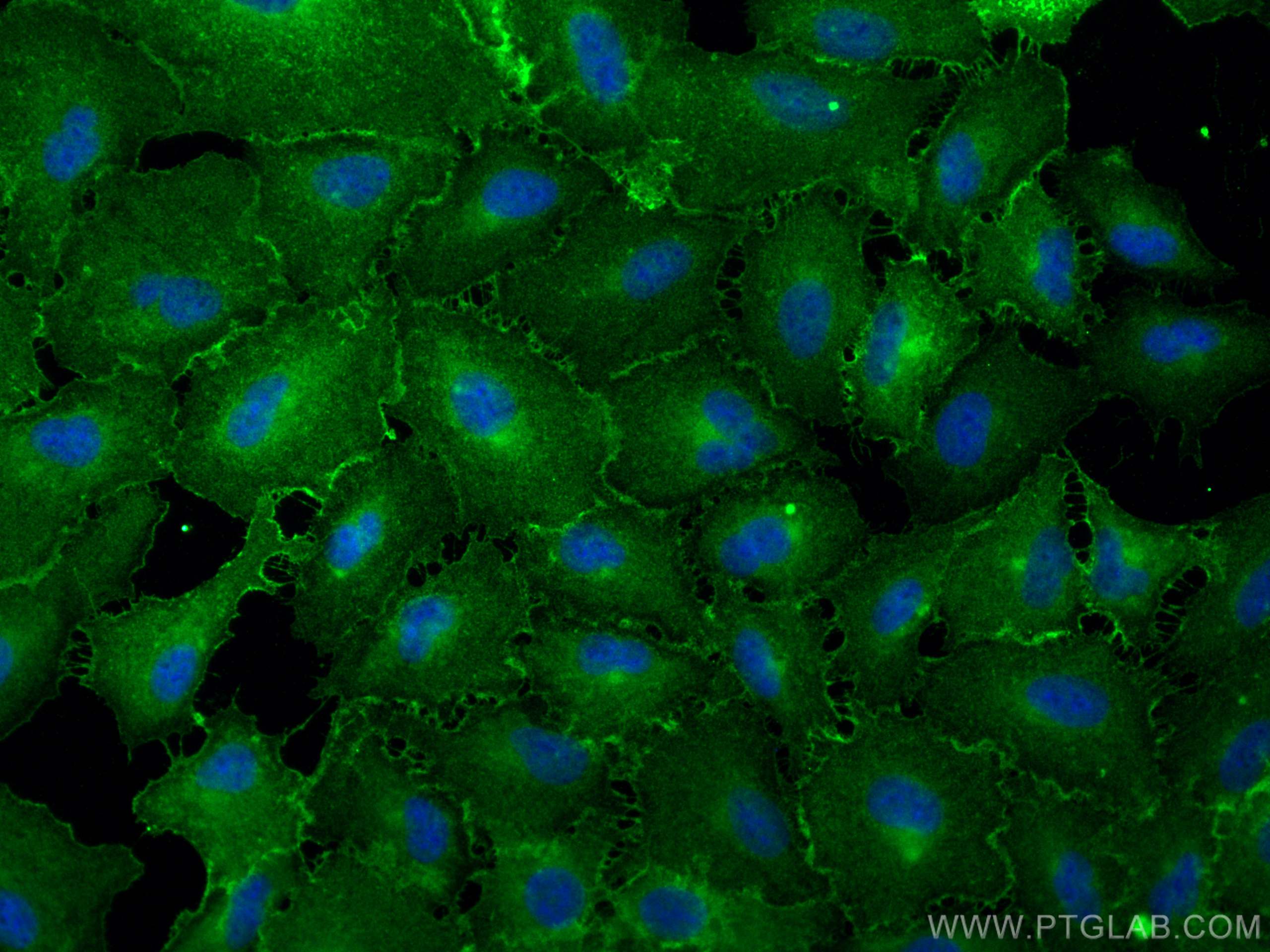 Immunofluorescence (IF) / fluorescent staining of A549 cells using Integrin Alpha 3 Polyclonal antibody (21992-1-AP)