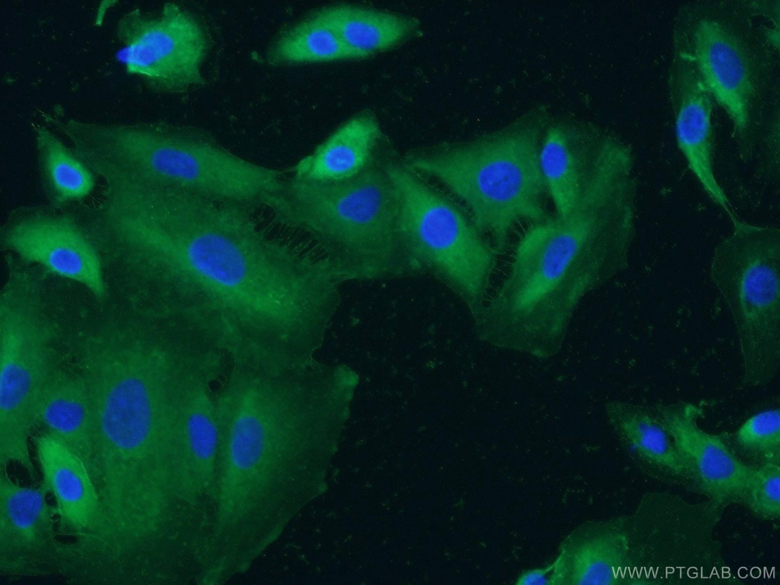 Integrin Alpha 3 Polyclonal antibody