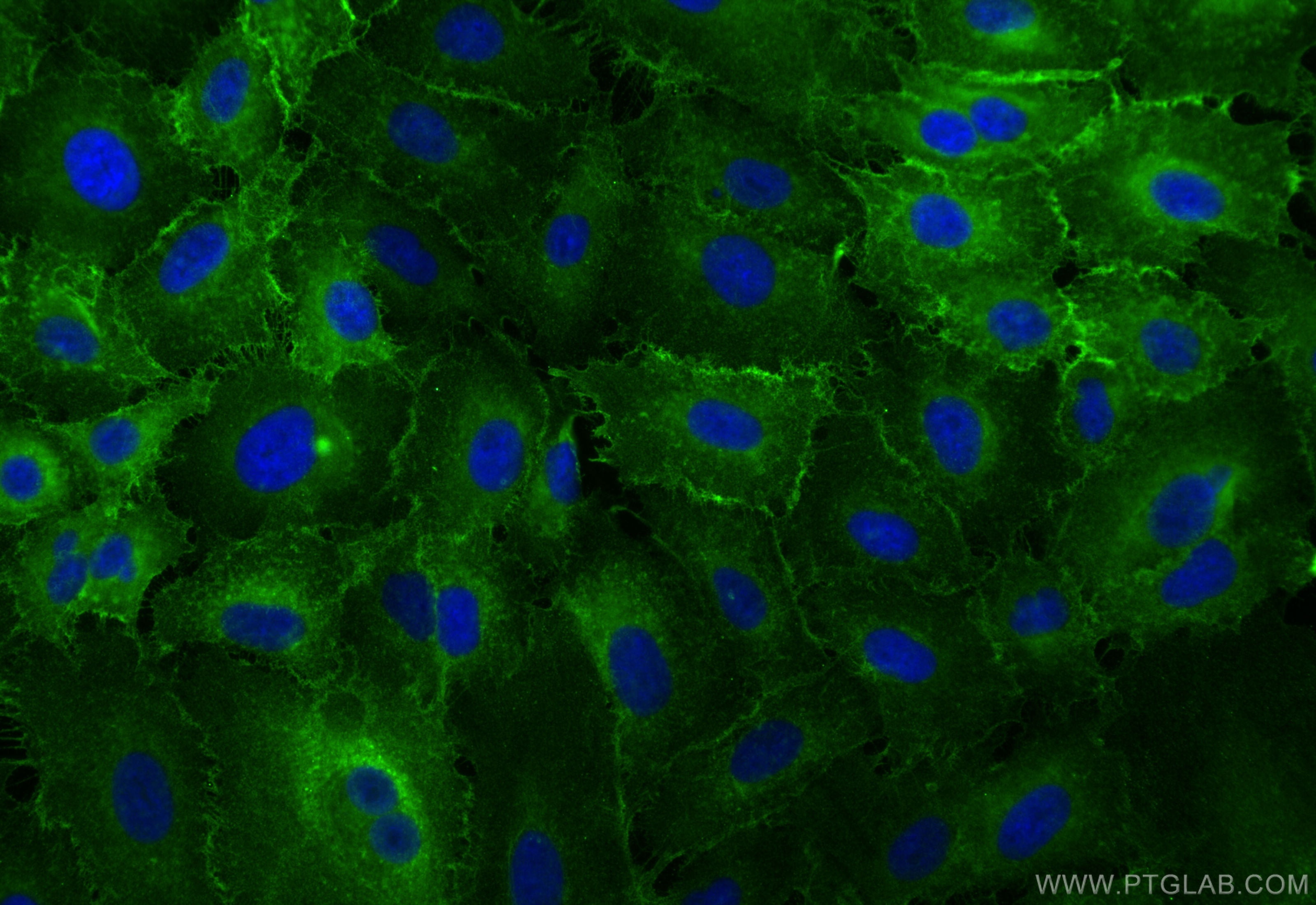 Immunofluorescence (IF) / fluorescent staining of A549 cells using Integrin Alpha 3 Polyclonal antibody (21992-1-AP)