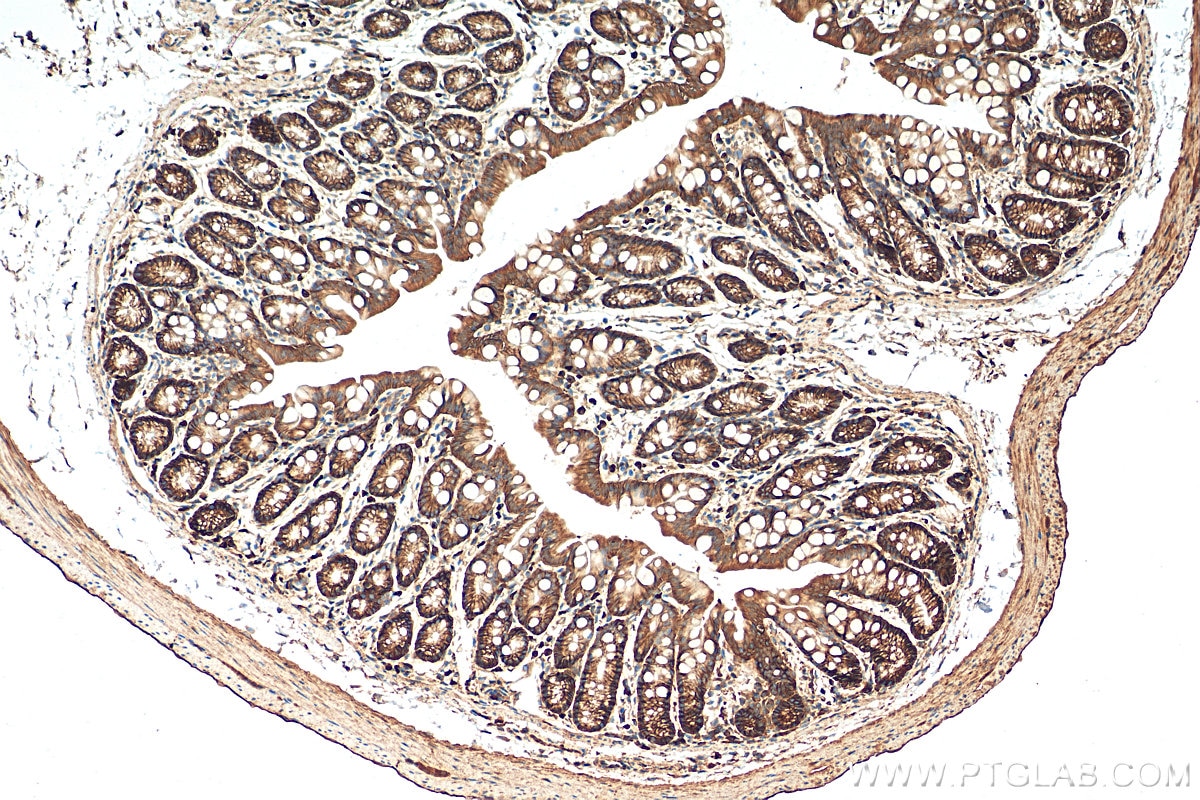 Immunohistochemistry (IHC) staining of mouse colon tissue using Integrin Alpha 3 Polyclonal antibody (21992-1-AP)