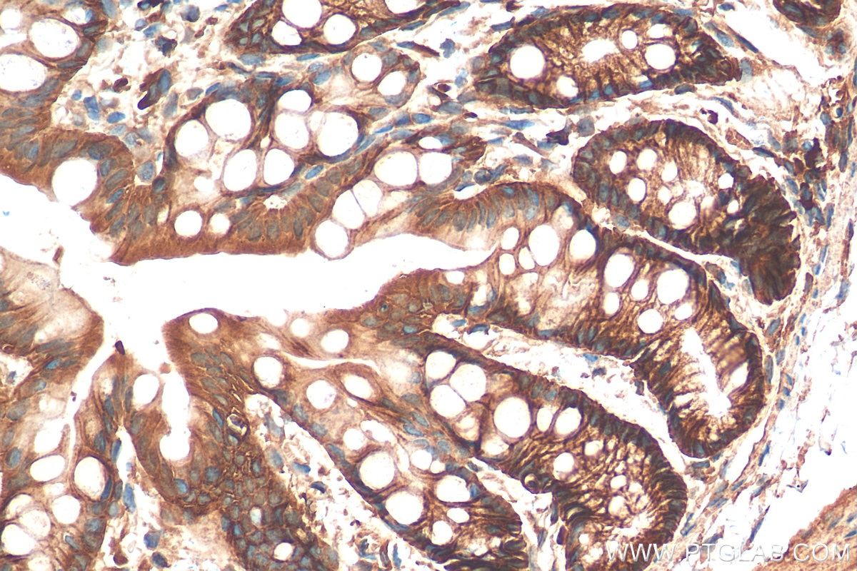 Immunohistochemistry (IHC) staining of mouse colon tissue using Integrin Alpha 3 Polyclonal antibody (21992-1-AP)