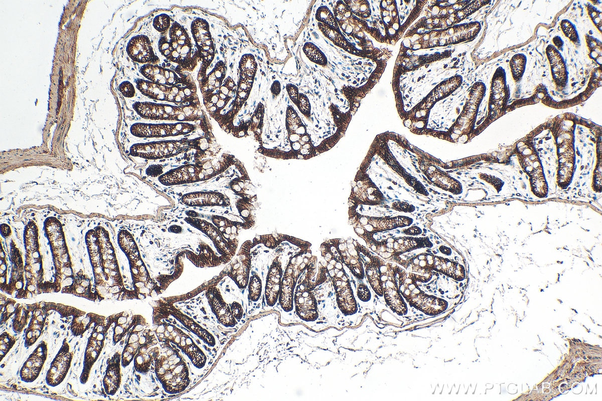 Immunohistochemistry (IHC) staining of mouse colon tissue using Integrin Alpha 3 Polyclonal antibody (21992-1-AP)