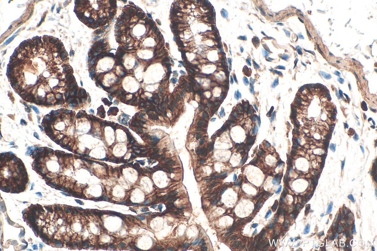 Immunohistochemistry (IHC) staining of mouse colon tissue using Integrin Alpha 3 Polyclonal antibody (21992-1-AP)