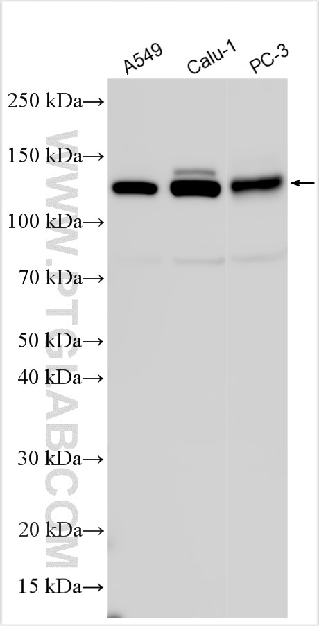 Western Blot (WB) analysis of various lysates using Integrin Alpha 3 Polyclonal antibody (21992-1-AP)