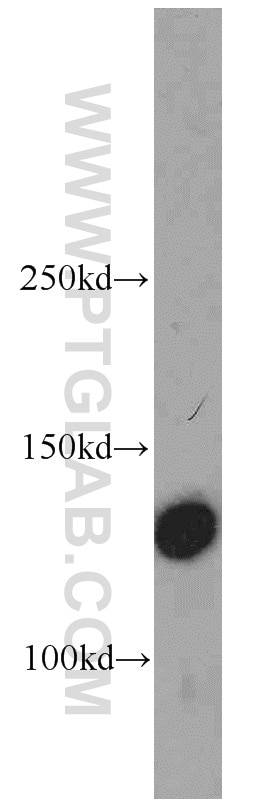 Western Blot (WB) analysis of human heart tissue using Integrin Alpha 3 Polyclonal antibody (21992-1-AP)