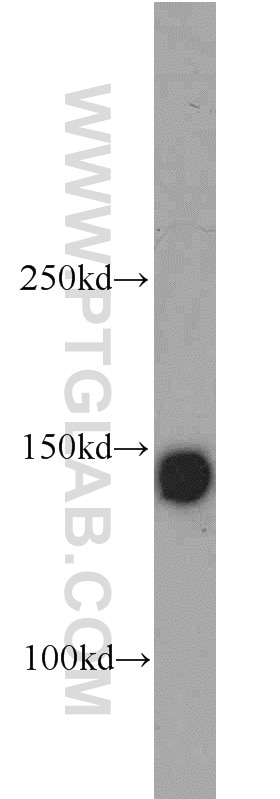 Western Blot (WB) analysis of human testis tissue using Integrin Alpha 3 Polyclonal antibody (21992-1-AP)