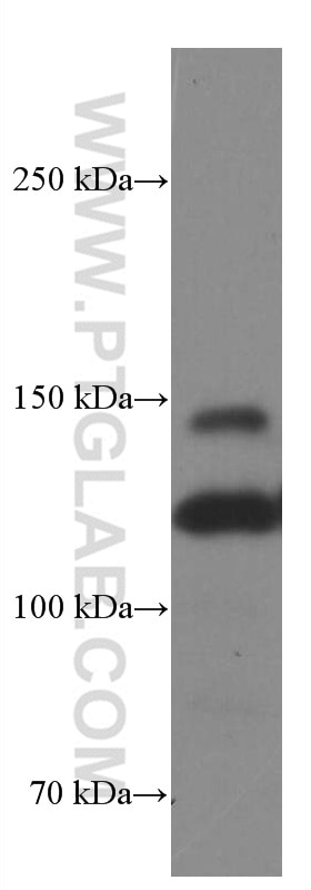 Western Blot (WB) analysis of A431 cells using Integrin Alpha 3 Monoclonal antibody (66070-1-Ig)