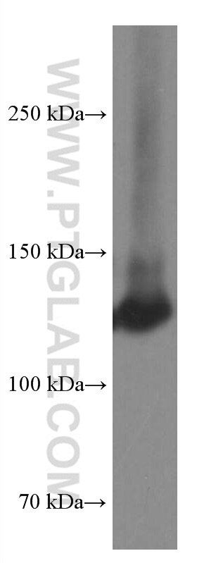 Western Blot (WB) analysis of A549 cells using Integrin Alpha 3 Monoclonal antibody (66070-1-Ig)