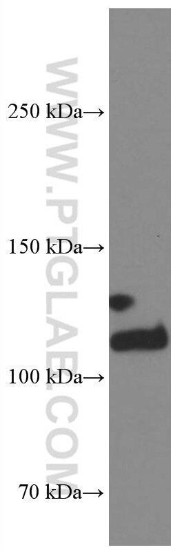 Western Blot (WB) analysis of mouse brain tissue using Integrin Alpha 3 Monoclonal antibody (66070-1-Ig)