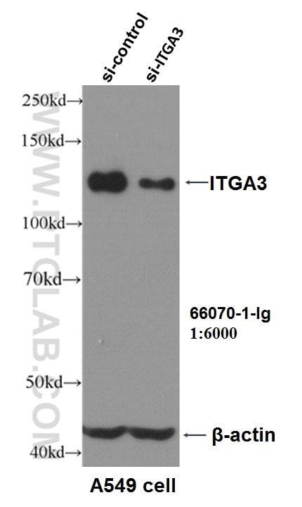 Integrin Alpha 3 Monoclonal antibody