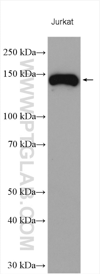 Western Blot (WB) analysis of various lysates using Integrin Alpha 4 Polyclonal antibody (19676-1-AP)