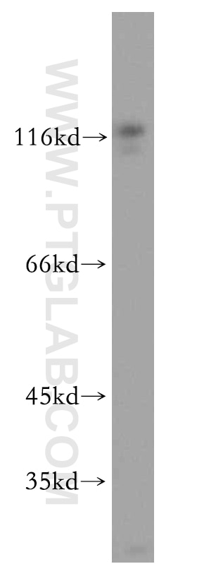 Integrin Alpha 4 Polyclonal antibody