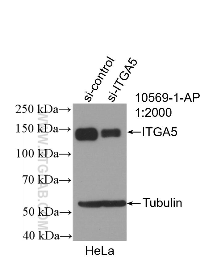 Western Blot (WB) analysis of HeLa cells using Integrin Alpha-5 Polyclonal antibody (10569-1-AP)