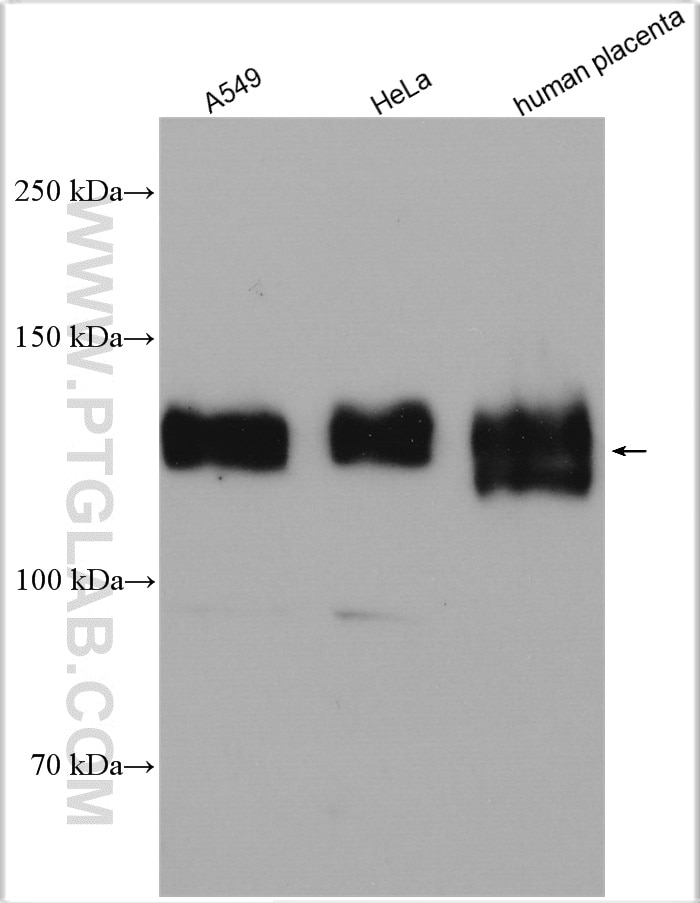 Western Blot (WB) analysis of various lysates using Integrin Alpha-5 Polyclonal antibody (10569-1-AP)