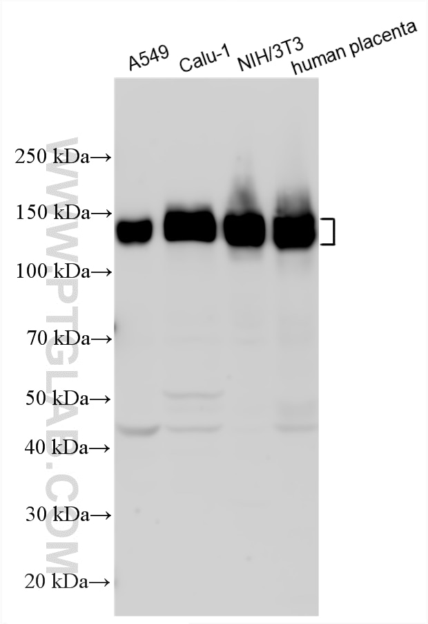 Various lysates were subjected to SDS PAGE followed by western blot with 10569-1-AP (Integrin alpha-5/CD49e antibody) at dilution of 1:4000 incubated at room temperature for 1.5 hours. Western Blot (WB) analysis of various lysates using Integrin alpha-5/CD49e Polyclonal antibody (10569-1-AP)