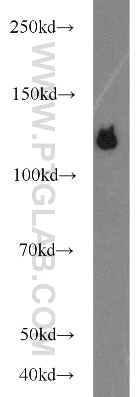 Integrin Alpha-5