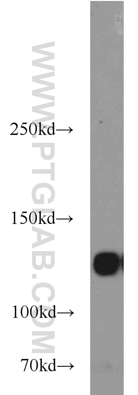 Western Blot (WB) analysis of 3T3-L1 cells using Integrin Alpha-5 Polyclonal antibody (10569-1-AP)