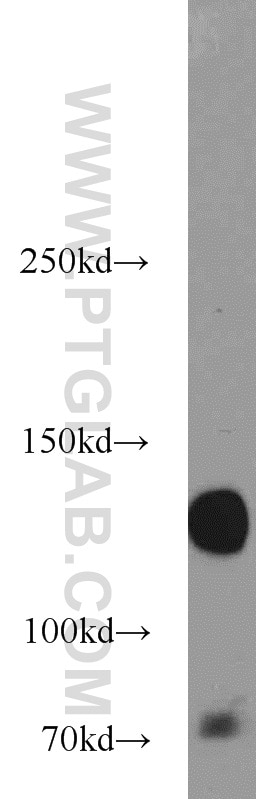 Integrin Alpha-5 Polyclonal antibody