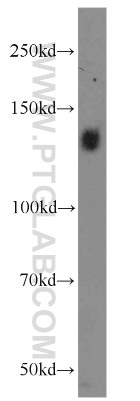 Western Blot (WB) analysis of HeLa cells using Integrin Alpha-5 Polyclonal antibody (10569-1-AP)