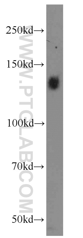 WB analysis of HeLa using 10569-1-AP