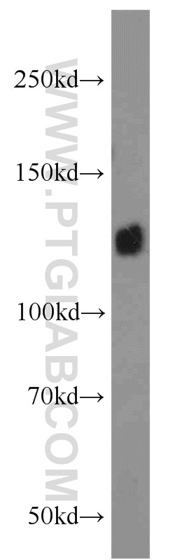 Western Blot (WB) analysis of A549 cells using Integrin Alpha-5 Polyclonal antibody (10569-1-AP)