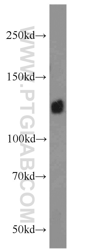 WB analysis of A549 using 10569-1-AP