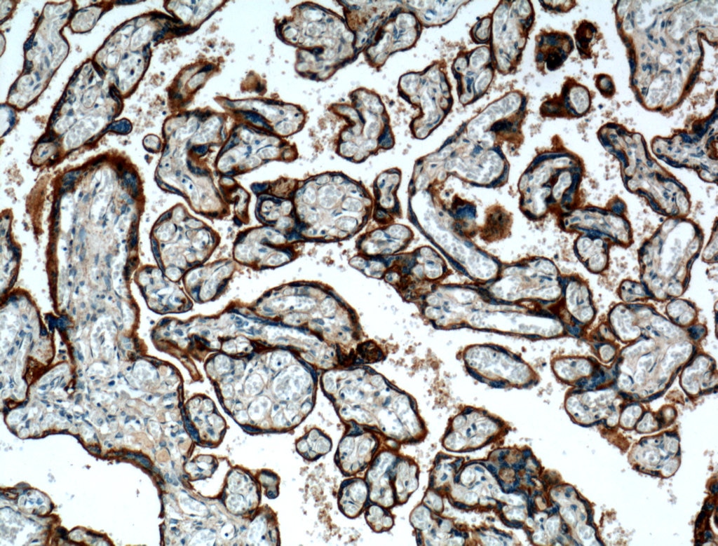 IHC staining of human placenta using 27224-1-AP