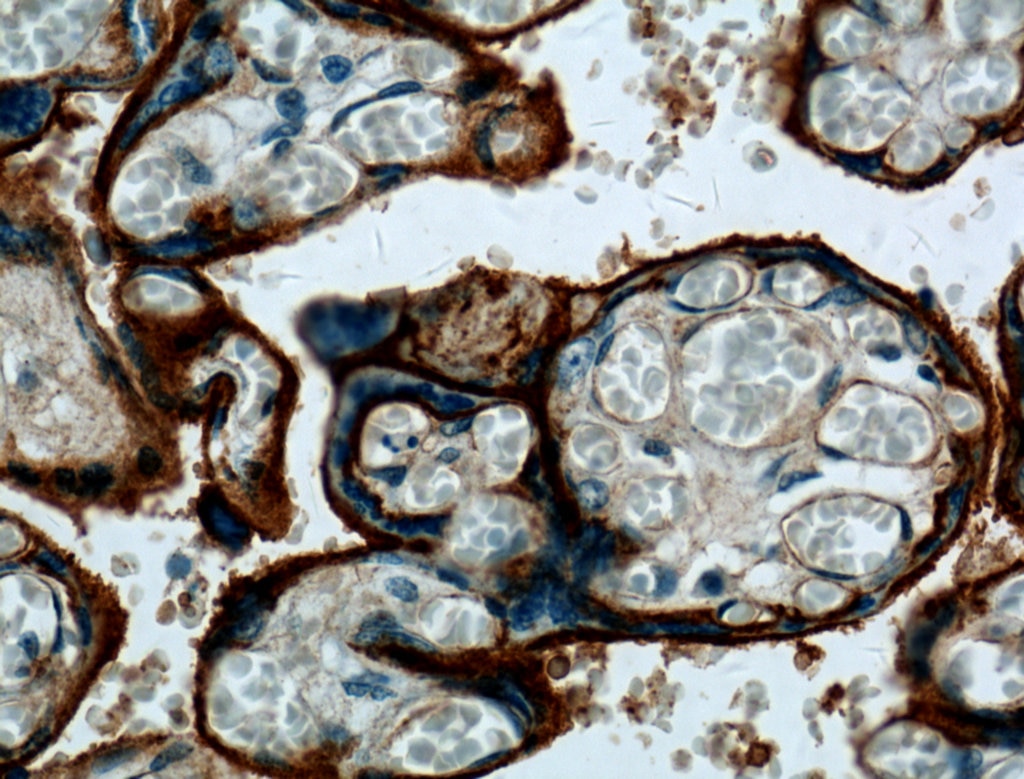 IHC staining of human placenta using 27224-1-AP