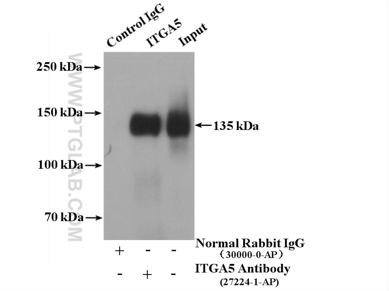 Immunoprecipitation (IP) experiment of human placenta tissue using Integrin Alpha 5 Polyclonal antibody (27224-1-AP)