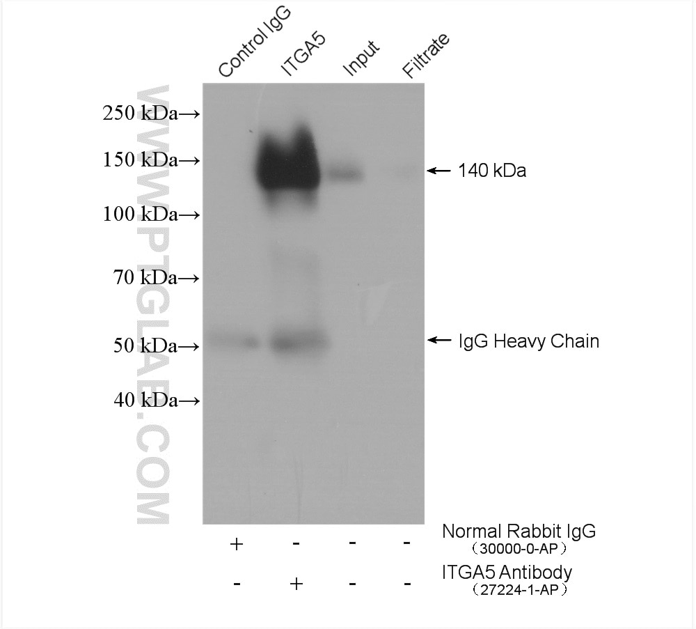 Immunoprecipitation (IP) experiment of human placenta tissue using Integrin Alpha 5 Polyclonal antibody (27224-1-AP)