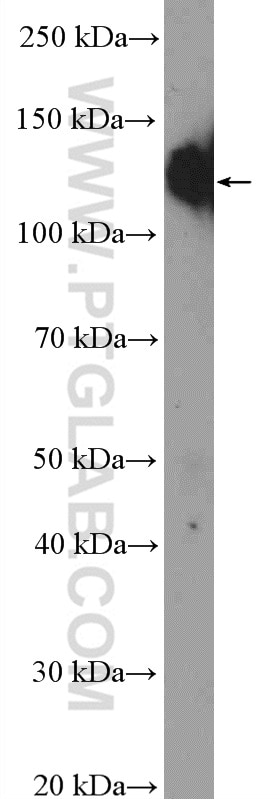 Western Blot (WB) analysis of human placenta tissue using Integrin Alpha 5 Polyclonal antibody (27224-1-AP)