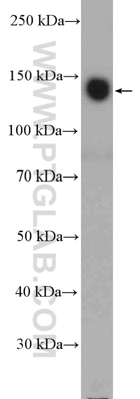 Western Blot (WB) analysis of A549 cells using Integrin Alpha 5 Polyclonal antibody (27224-1-AP)